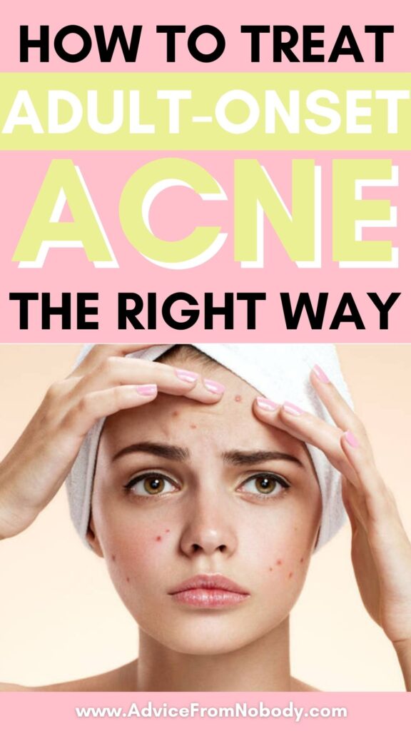 how to treat adult acne and why you might have it
