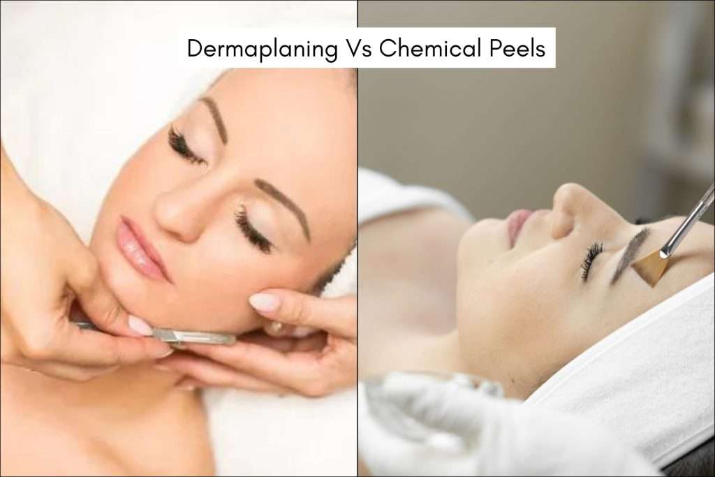 dermaplaning vs chemical peel