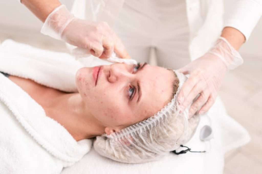 best spa facial for acne