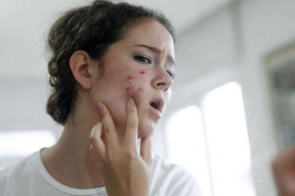 does dermaplaning cause acne
