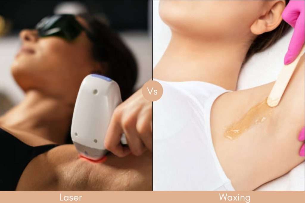 waxing vs laser hair removal
