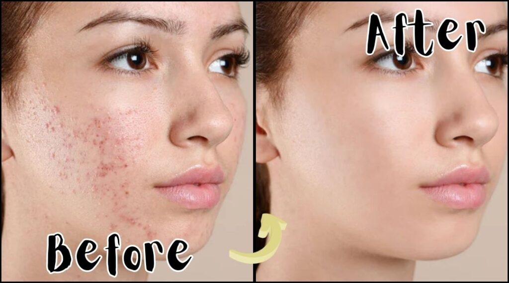 skincare for clear skin